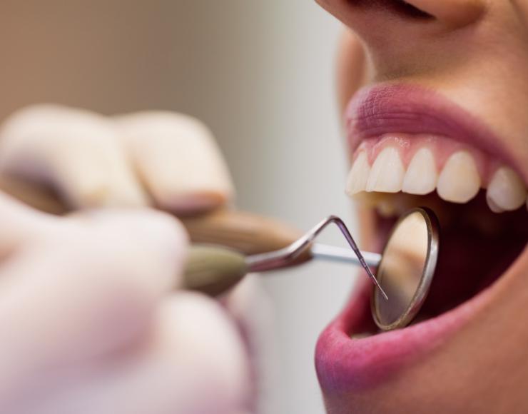 Darbo pasiūlymas burnos higienistui